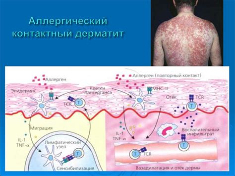 Биокомпатибельность и аллергические реакции