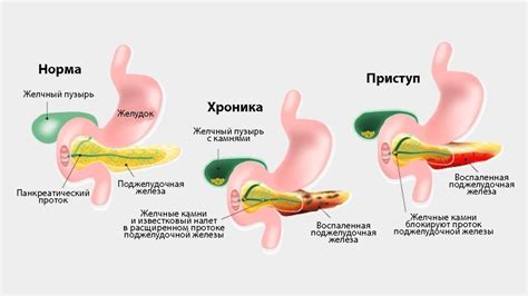 Блокировка по железу: причины и последствия