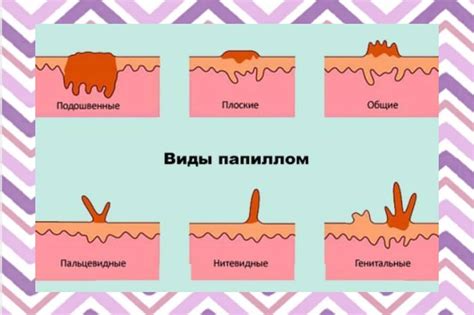 Болезненность и зуд в области папиллом на груди - один из главных симптомов