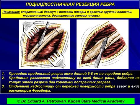 Важные сведения о кисте на грудной железе