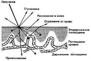 Взаимодействие лазерного луча с загрязнениями