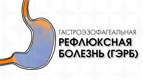 Влияние гастроэзофагеальной рефлюксной болезни