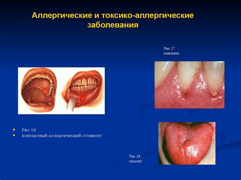 Влияние полости рта и слизистой на восприятие вкуса