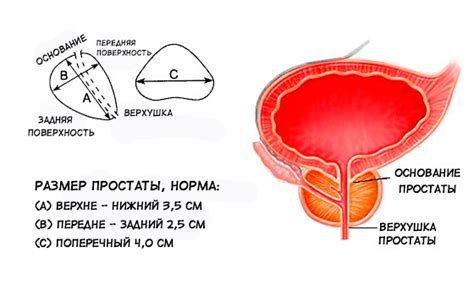 Возможности использования чрезпузырного доступа в различных патологиях предстательной железы