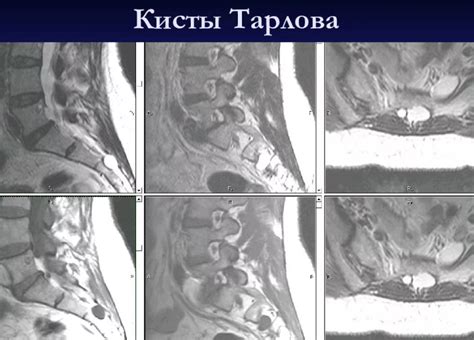 Возможные осложнения послеоперационной кисты