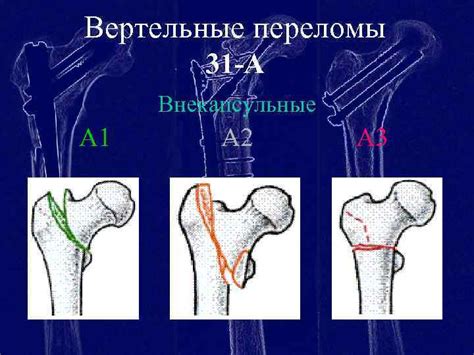 Возможные повреждения и деформации