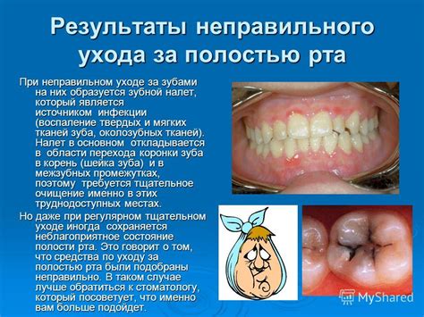 Возможные причины, связанные с зубами и ротовой полостью