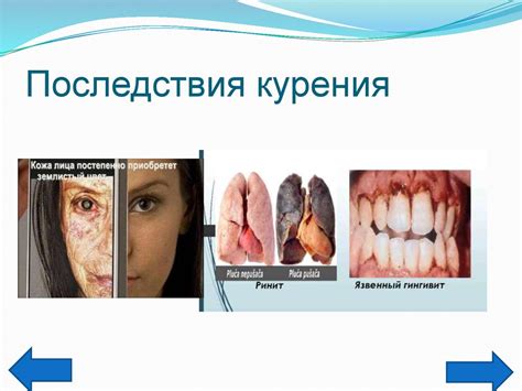 Вредные последствия тонкого ободка