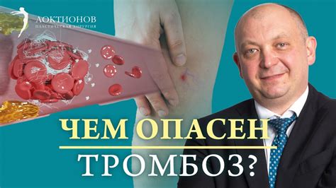 Всемирный день тромбоза: причины, симптомы и профилактика 