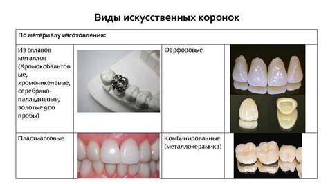 Выбор металлических коронок по материалу