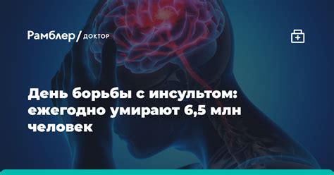 День борьбы с инсультом: все, что нужно знать