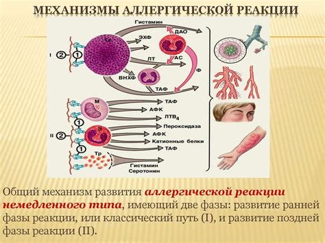 Диагностика аллергической реакции на металлы