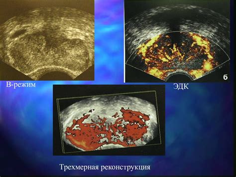 Диагностика заболеваний предстательной железы