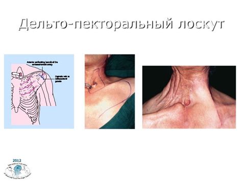 Добавление крыльев и шеи