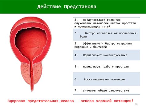 Заболевания предстательной железы