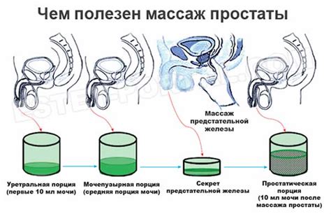 Зачем нужен самомассаж предстательной железы