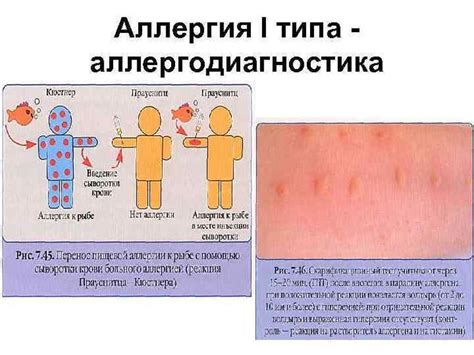 Исключение аллергических реакций