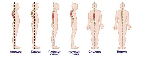 Искривления и деформации