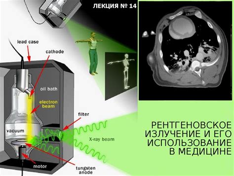 Использование неферромагнетика в медицине