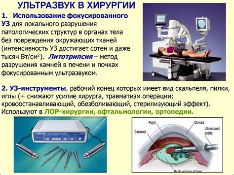 Использование ультразвука