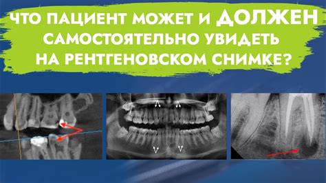 Каким образом рентгеновское исследование позволяет определить состав металлических материалов?