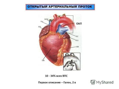 Как связаться с отделением ВПС Бакулева