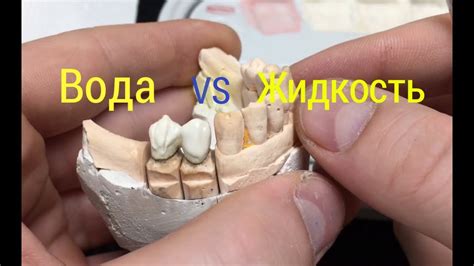 Как сделать коронку: пошаговая инструкция