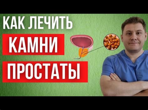 Лечение болей в предстательной железе