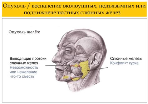 Лечение объемного образования околоушной слюнной железы