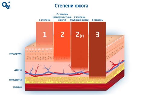 Лечение ожога арматуры: медицинские рекомендации