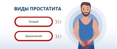 Лечение простатита: важные методы