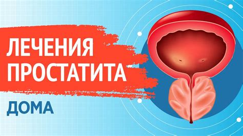 Медикаментозное лечение простатита: основные препараты