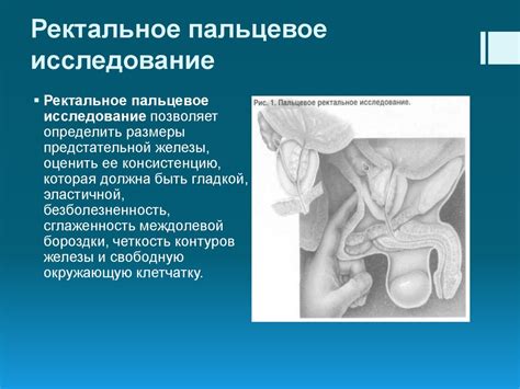 Методы внутренней пальпации предстательной железы