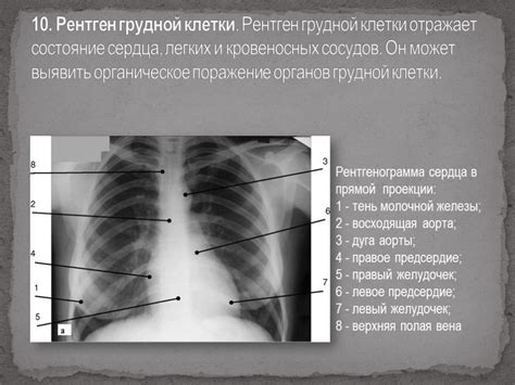 Неинвазивность