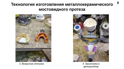 Необъемные сплавы и их особенности при изготовлении коронок: