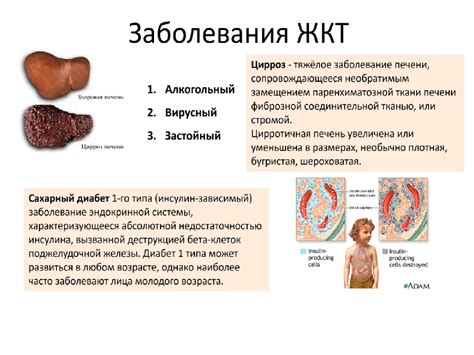 Обратите внимание на состояние вашего желудочно-кишечного тракта