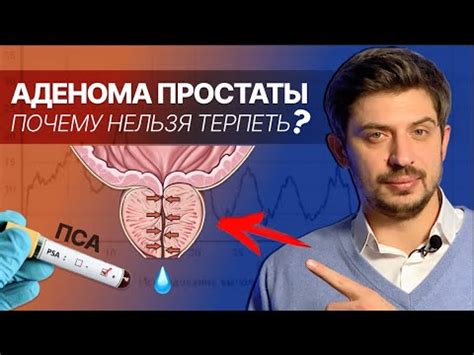 Обследование предстательной железы: места, где это возможно