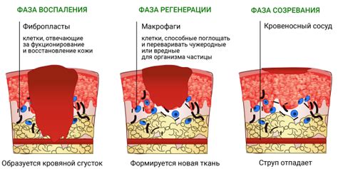 Ожоги металлом: причины и последствия