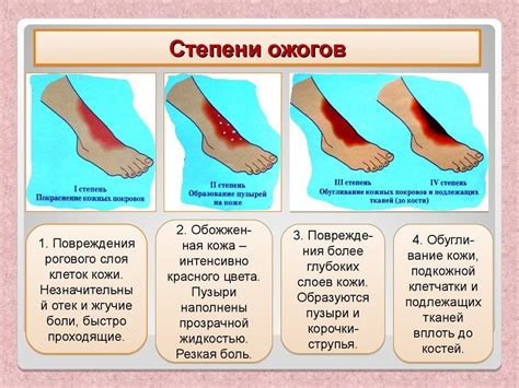 Ожоги металлом: факторы риска и первая помощь