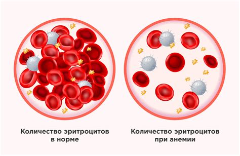 Основы повышения образования гемоглобина в крови при нормальном содержании железа