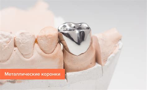 Особенности использования металлической коронки