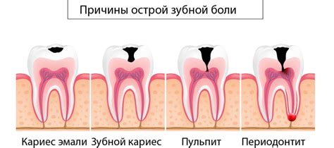 Острая и заточенная зубная геометрия