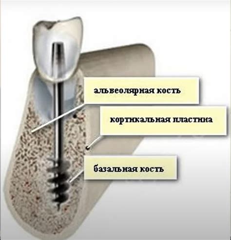 Плюсы и минусы замены пескоструя