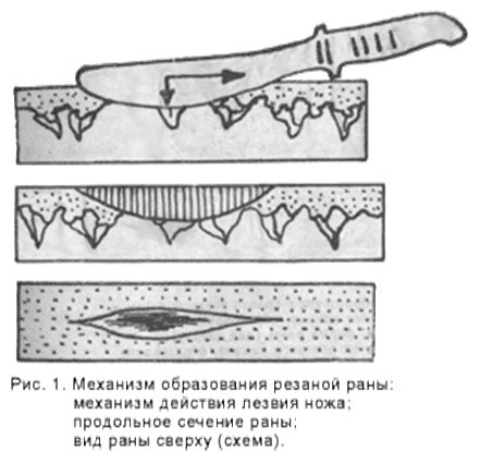 Поведение металлов на краях резаных ран