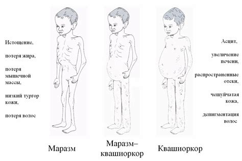 Получение гиппокампов