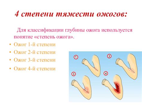 Понятие ожога металла