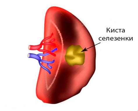 Потенциальные опасности при разрезании