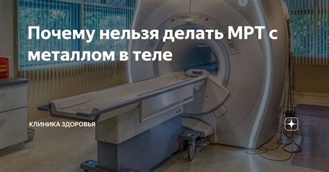 Почему стоит избегать МРТ с металлом на теле: опасности и последствия