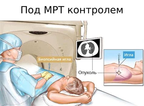 Преимущества самомассажа предстательной железы перед другими методами