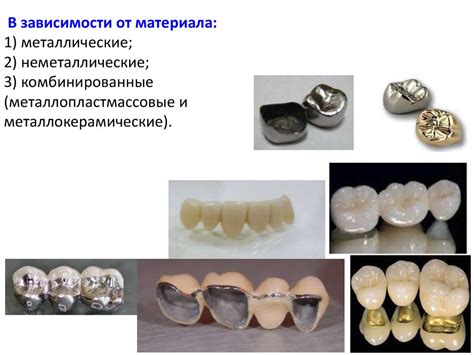 Применение штампованных коронок